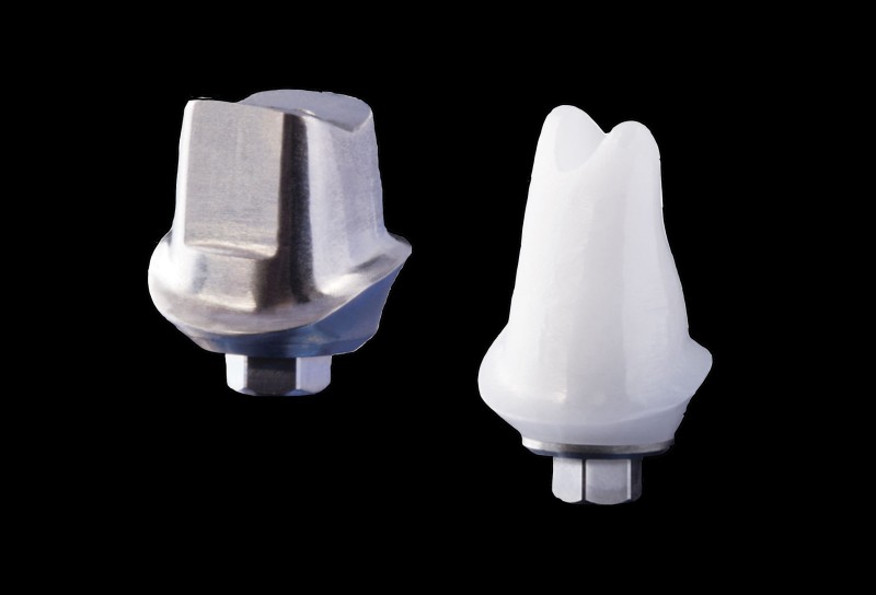 Implant Restorations