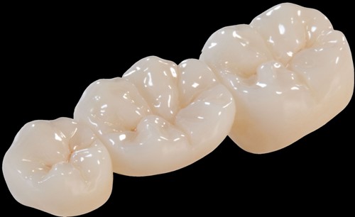 zirconia crown and bridge